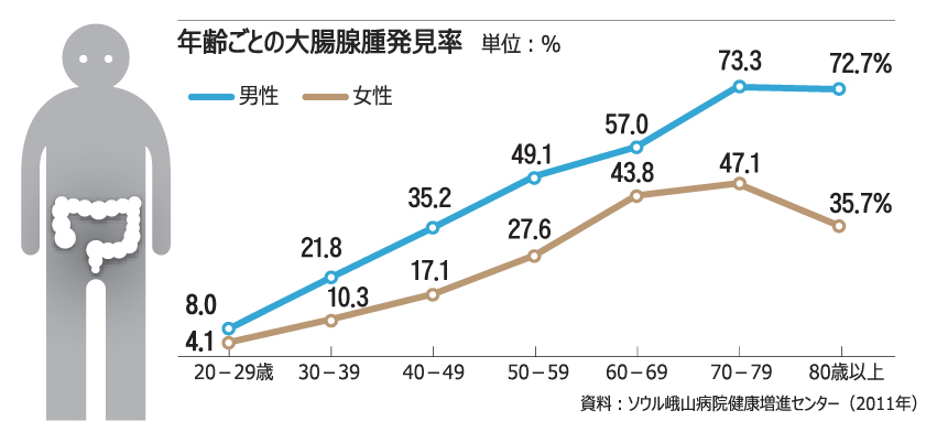 50代以上の男性52%から大腸腺腫発見 