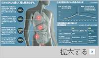 日本人の「がん」に学べ、韓国でも10年以内に乳がん増