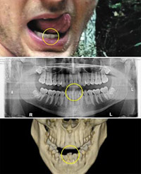 北朝鮮、故ワームビアさんをペンチと電気ショックで拷問か