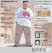 心臓病も3代世襲？　金正恩委員長の体は「総合病棟」