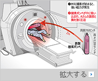 MRIの磁力に吸い込まれた酸素ボンベで患者死亡…警察の結論は医療過誤　／金海