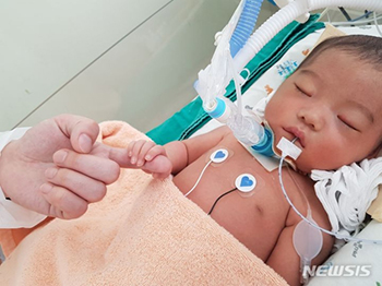 ▲脳死臓器提供で4人に新たな「命」を分け与えてこの世を去ったチョン・アヨンちゃん。写真提供＝韓国臓器組織提供院