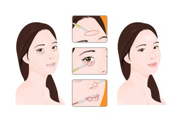 「ここがなぜ地獄なのかお見せしましょう」　江南の美容整形街や学習塾街が外国人客ダークツーリズムの対象に　／ソウル