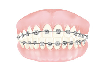 ▲イラスト＝UTOIMAGE