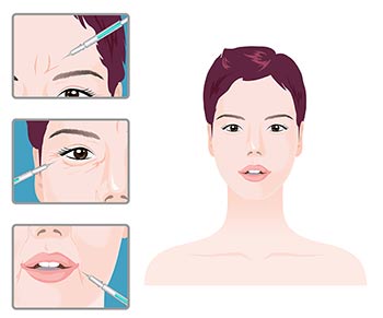 ▲イラスト＝UTOIMAGE