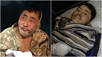 ▲ロシアのクルスク州でウクライナ軍の捕虜となった北朝鮮軍兵士のイ某氏（26）とペク某氏（20）／X