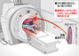 MRIが磁力で酸素ボンベを吸い込む…検査中の患者が挟まれ死亡　／金海