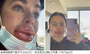 米国版「扇風機おばさん」の衝撃…20代女性が美容施術で巨大化した唇を公開