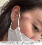 食事姿を生配信中の韓国20代女性ユーチューバー、同業者をフォークで攻撃して顔にけが負わせる　／富川